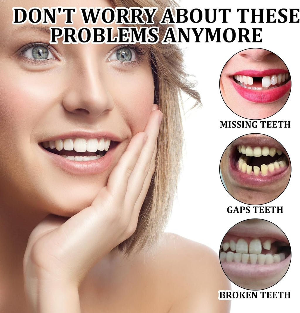 إبتسامة هوليود سمايل
